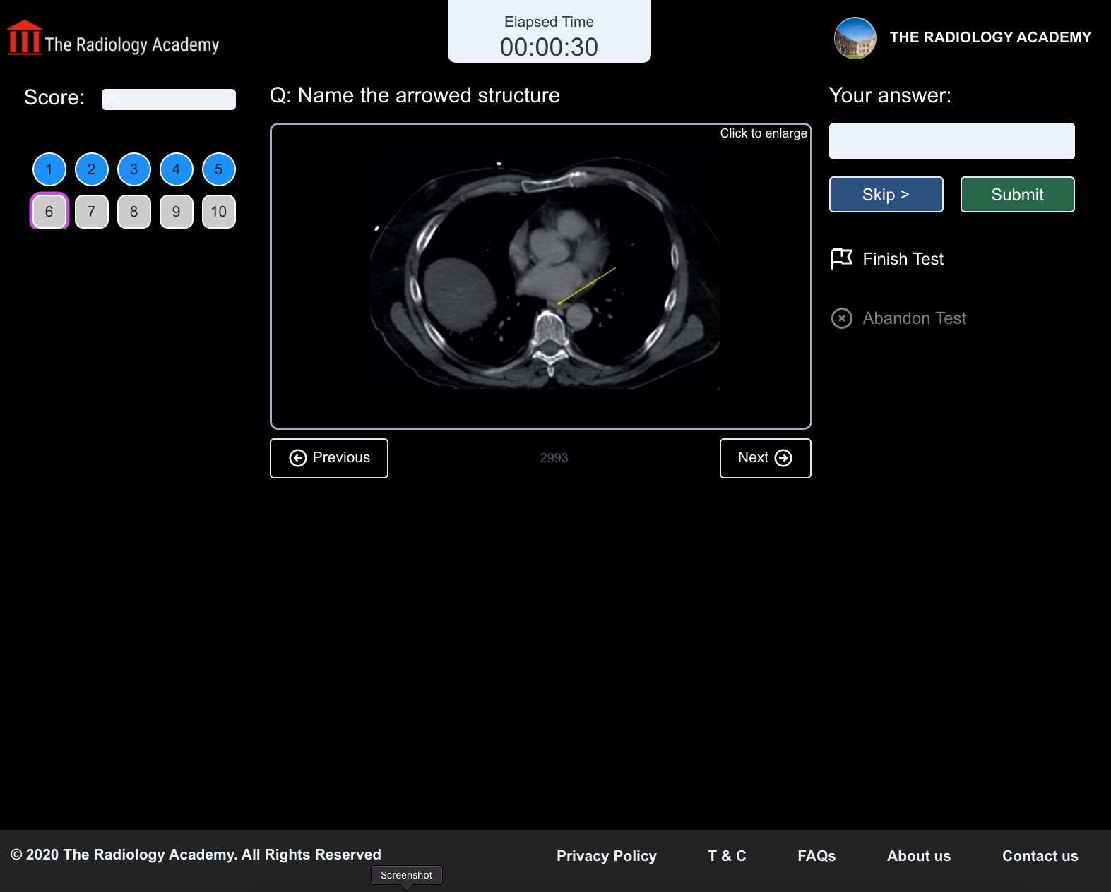 First FRCR Exam - Practice Exam Questions | The Radiology Academy